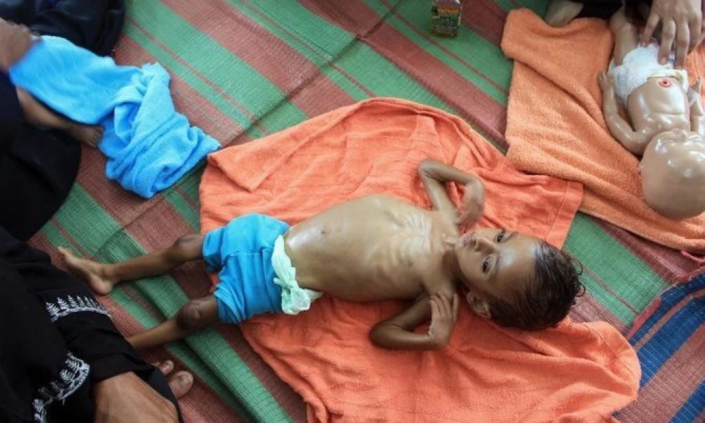 Υεμένη: “Πεθαίνουν της πείνας” τα μισά παιδιά κάτω των 5 ετών